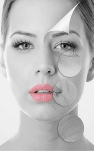 Cryolipolyse - cryo brest-cryothérapie - cryo